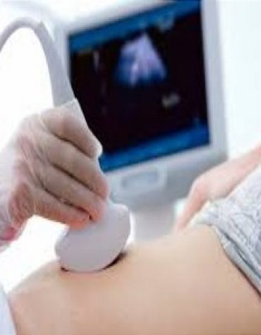 ULTRASOUND GEL