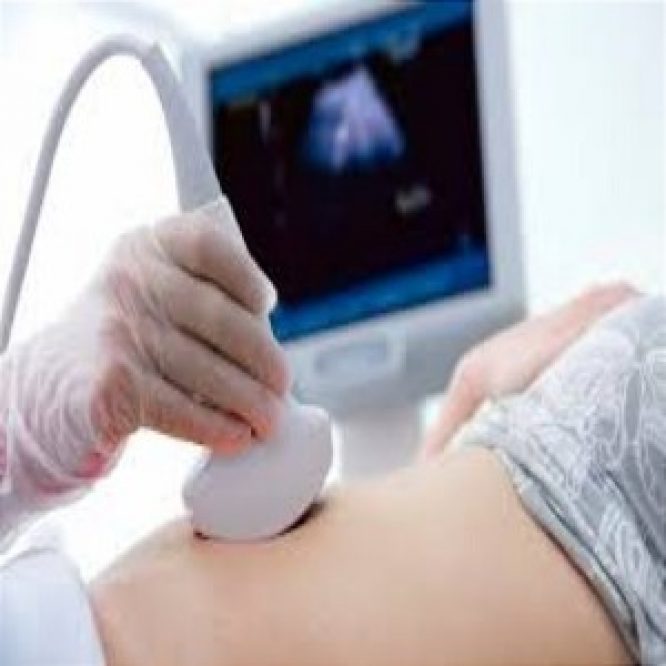 ULTRASOUND GEL